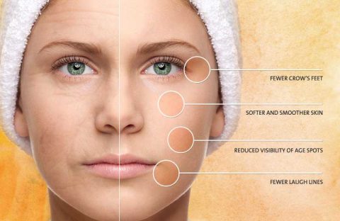 عکسی از رفع چین و چروک صورت با استفاده از این ترکیبات